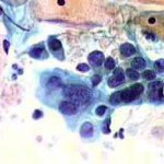 Δοκιμασία οξικού οξέως